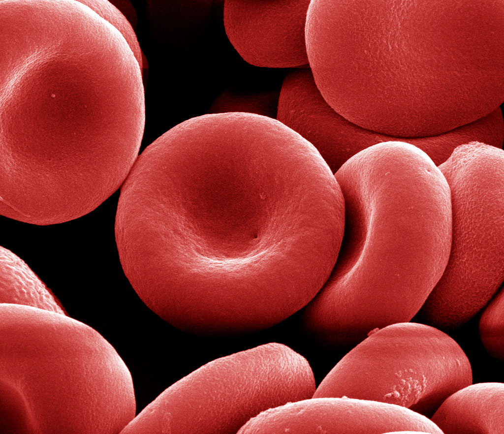 Red blood cells before being distorted into spiky spheres by the Sandia and University of New Mexico technique for possible commercial use.