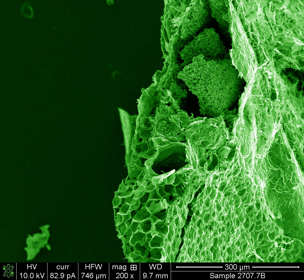 An electron microscope shows the heterogeneity of tissue available in a carbonized spleen.