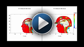Click on the thumbnail to view footage of a simulated traumatic brain injury.
