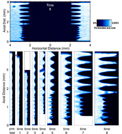 The top image is an X-ray