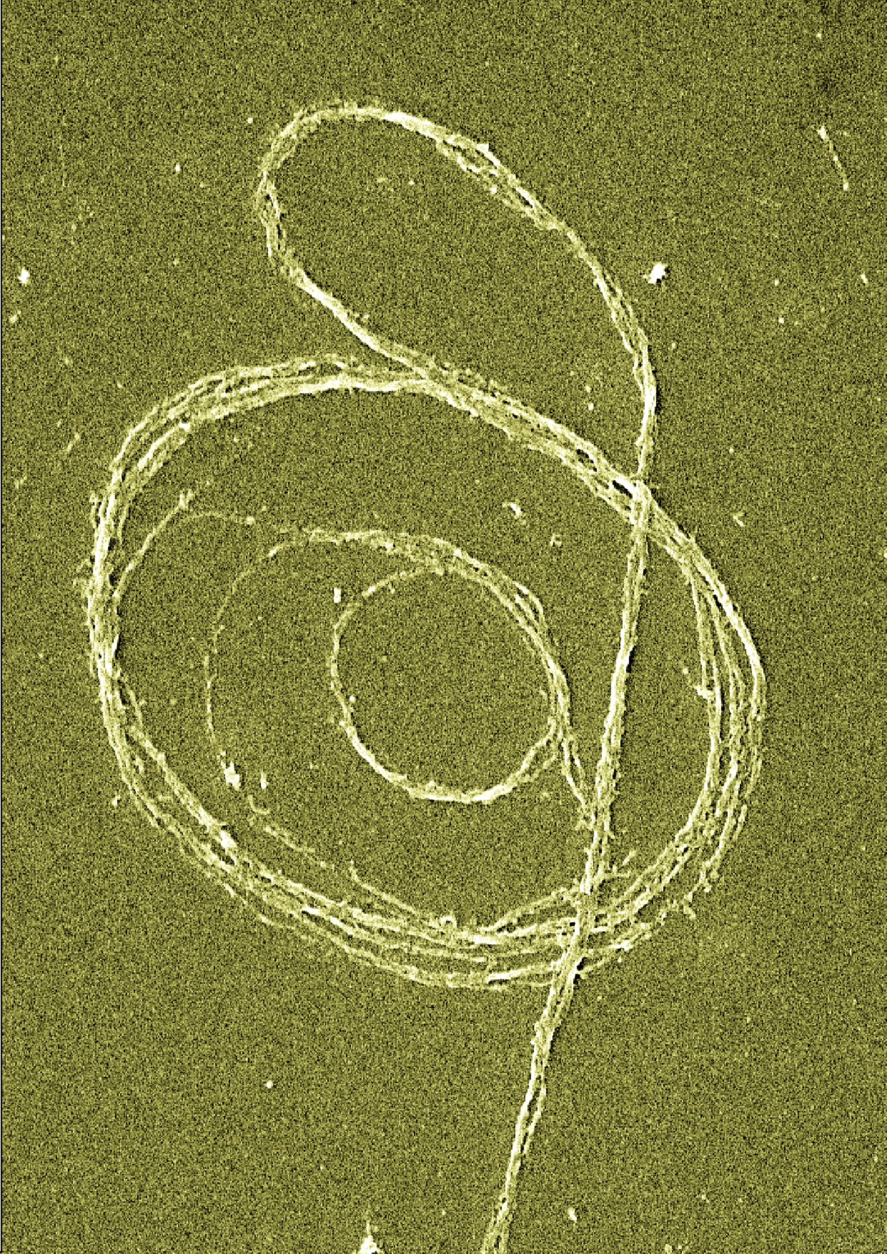 Scanning electron microscope image (tinted) of forming rings