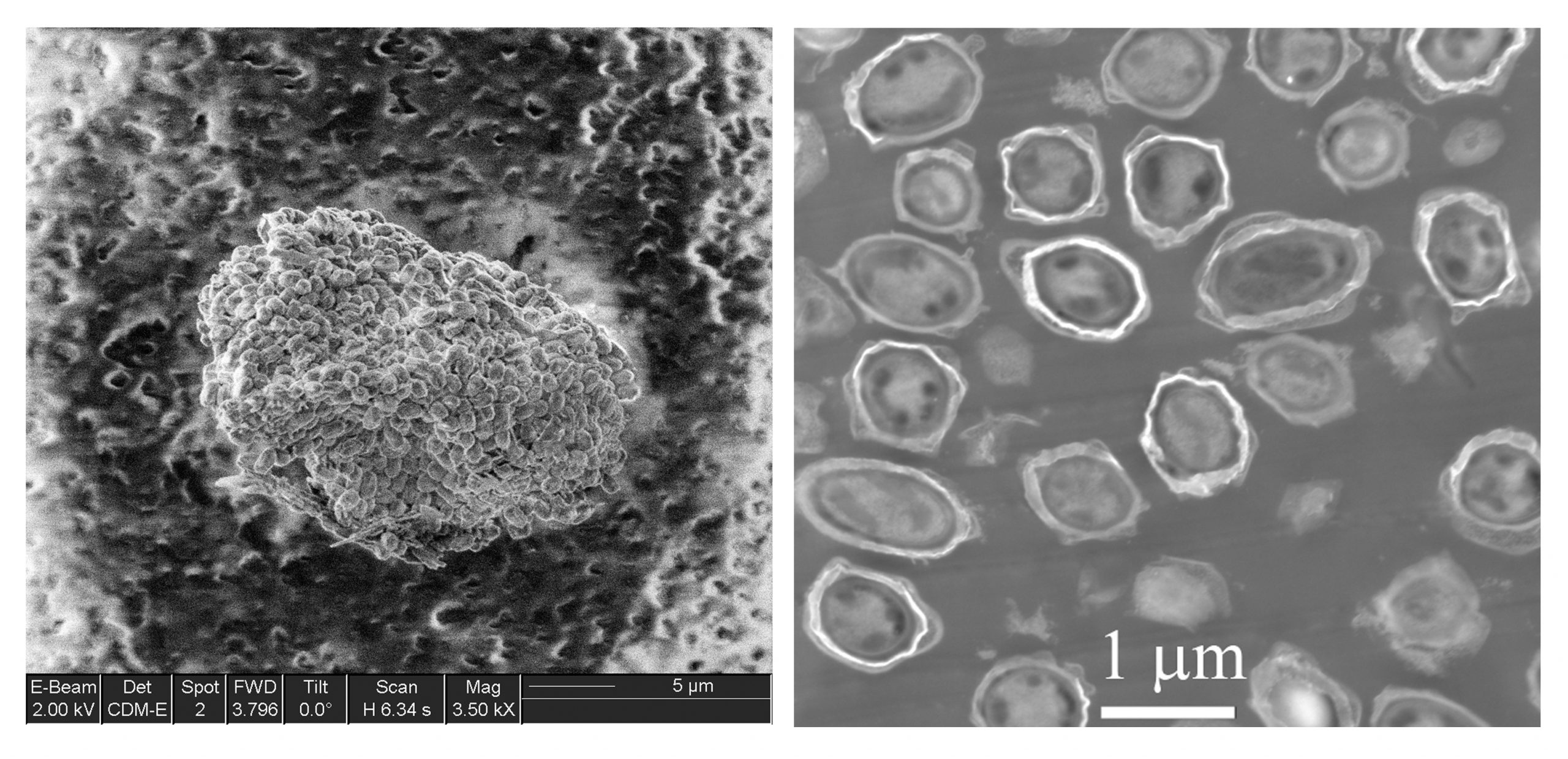 bacillus anthracis spores as viewed in SEM (left) and TEM (right). (Photo courtesy of Sandia National Laboratories) Download 300dpi 2.2MB JPEG image (Media are welcome to download/publish this image with related news stories.)