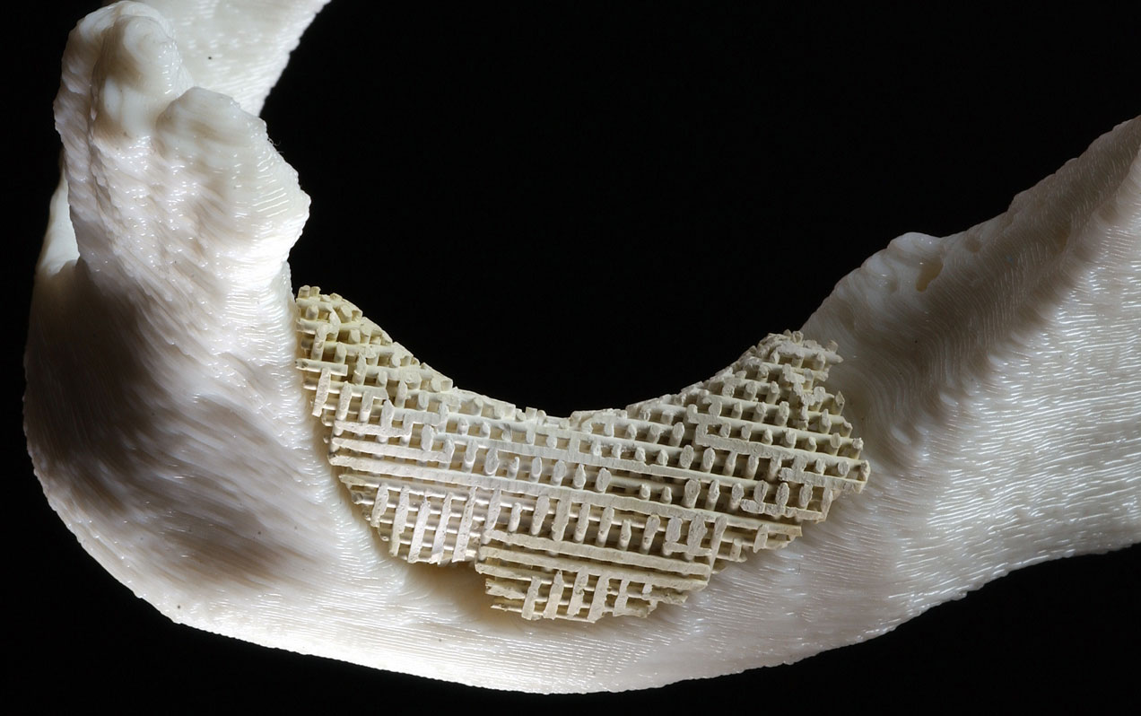 Perfection regained: the perfect fit of the Sandia ceramic scaffolding in the model jaw also recreates the upper line of the original jawbone. The scaffold layering, which cross each other like a child's Lincoln Logs, are approximately 500 microns apart to expedite passage of new bone and blood vessels. (Photo by Randy Montoya)