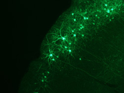 green fluorescent protein-labeled neurons in a mouse neocortex