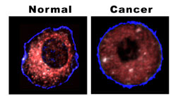 Difference between normal and cancerous cells